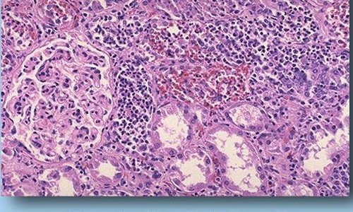 孕妇食谱排骨汤-【孕妇排骨汤怎么做有营养】孕妇吃的排骨汤怎么做的 - 孕妇吃的排骨汤怎么做网
